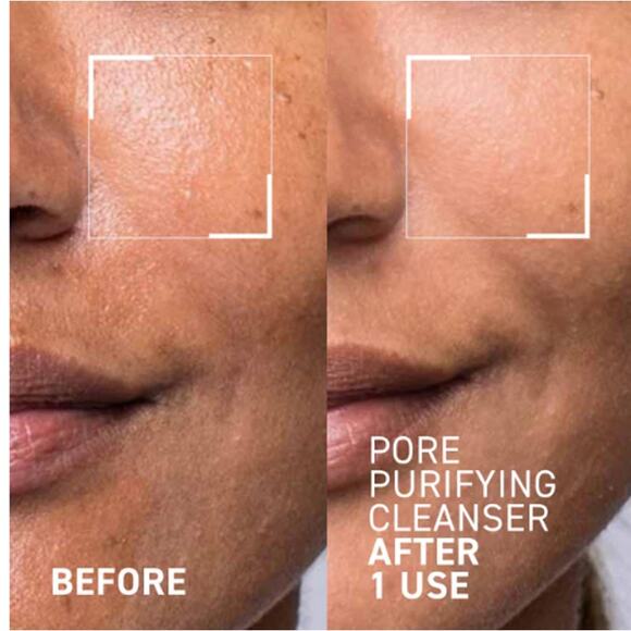 New Dr. Brandt PORES NO MORE PORE PURIFYING CLEANSER - Picture 2 of 3